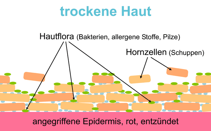 Trockene Haut